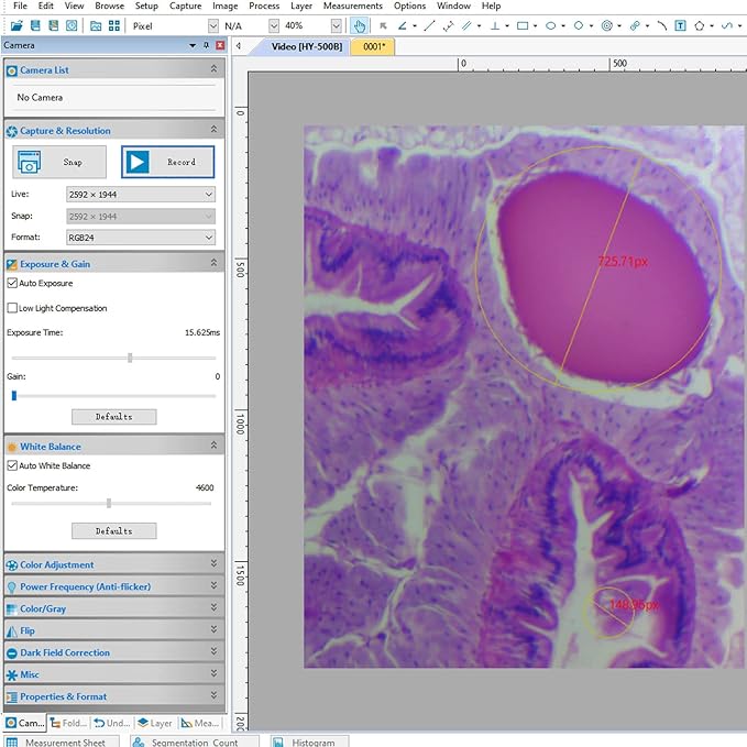 [5MP] Vabiooth USB 2.0 Digital Camera captures Still Images, Streams Live Videos, and is Compatible with WIN7/8/10/SP4/XP/VISTA, Mac, Linux